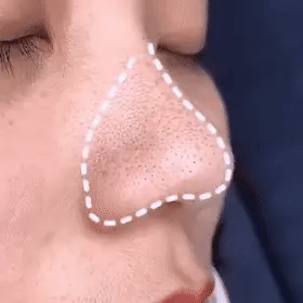 Anti-Blackhead Green Tea Miracle Stick - Removes Blackheads from Face and Nose