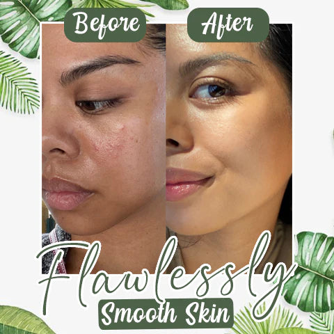 Anti-Blackhead Green Tea Miracle Stick - Removes Blackheads from Face and Nose