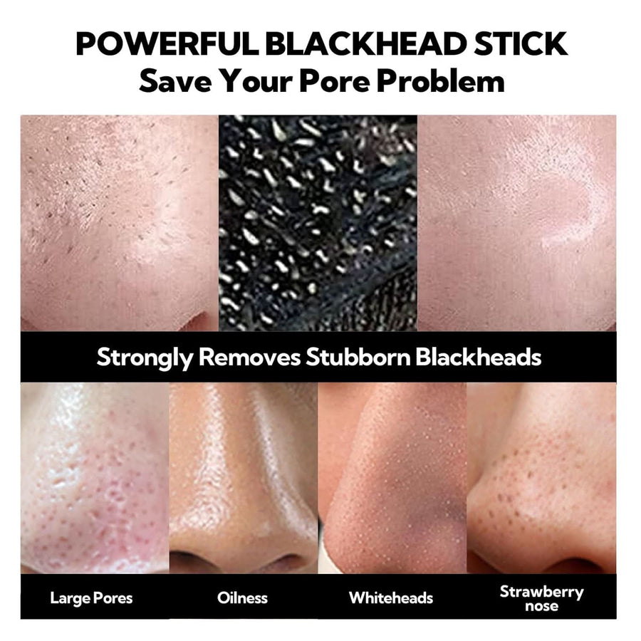 LANBENA Upgraded 2.0 Bamboo Charcoal Blackhead Remover Mask, 60 pcs Nose Strips, Peel off Face Mask Pore Whiteheads Cleanser Strawberry Nose Purifying, Deep Cleansing for All Skin Types, 30g/1.05oz - Sccoti