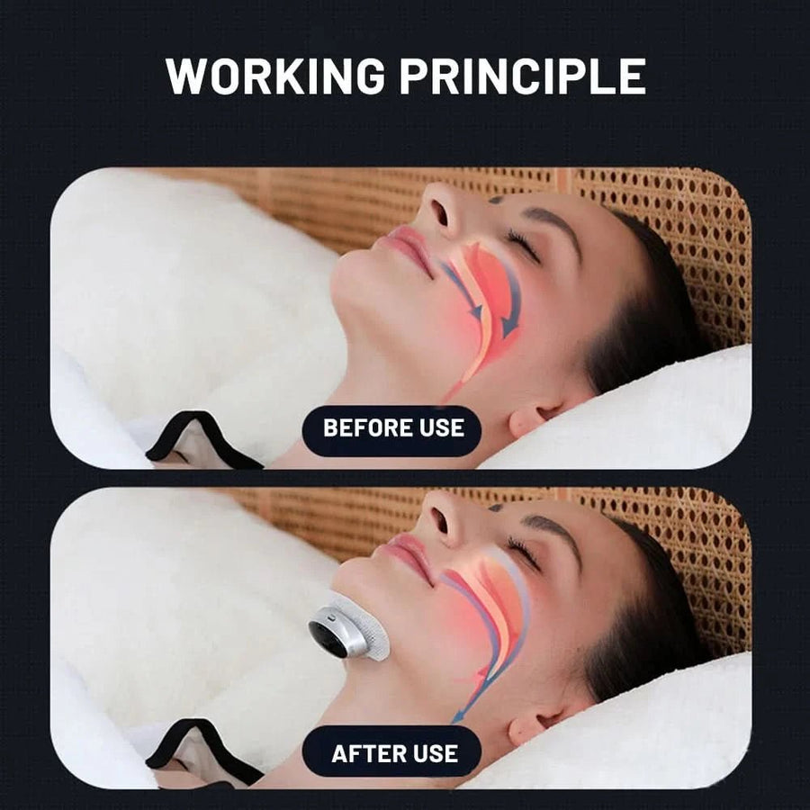 Health Care Sleep Apnea Aid Treatment Tool Breathing Corrector Smart Anti - snoring Device For Better Sleep - Sccoti
