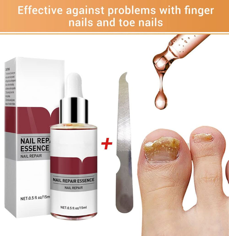 Lanbena Nail Repair Essence, Fingernail & Toenail Repair Nail Treatment 0.5fl.oz - Sccoti