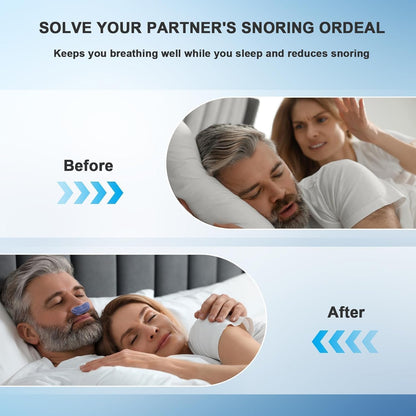 Double Vortex Anti Snoring Device - Effective Snoring Solution