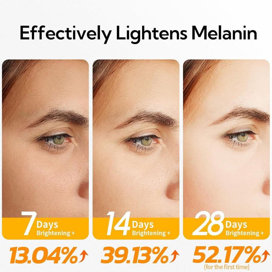 20% Vitamin C Serum For Face, Brightening Skin, Dark Spot Remover, Reduce Wrinkle, Anti Aging Glowing Serum, Facial Moisturizer with Niacinamide, Vitamin E, Hyaluronic Acid, 15 ML/ 0.51 Fl oz - Sccoti