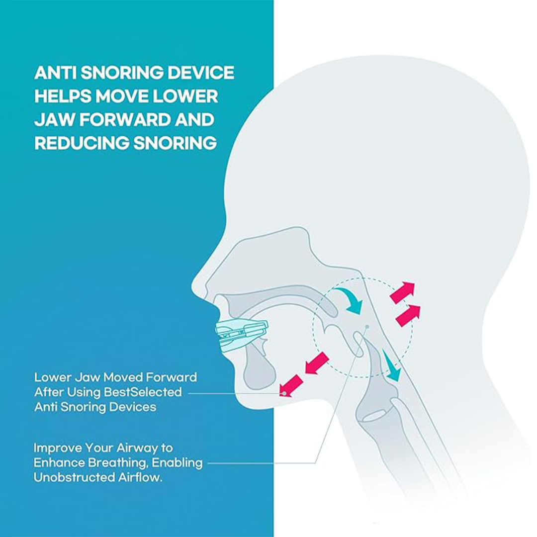 Flexible and adaptable anti-snoring and sleep apnea orthosis