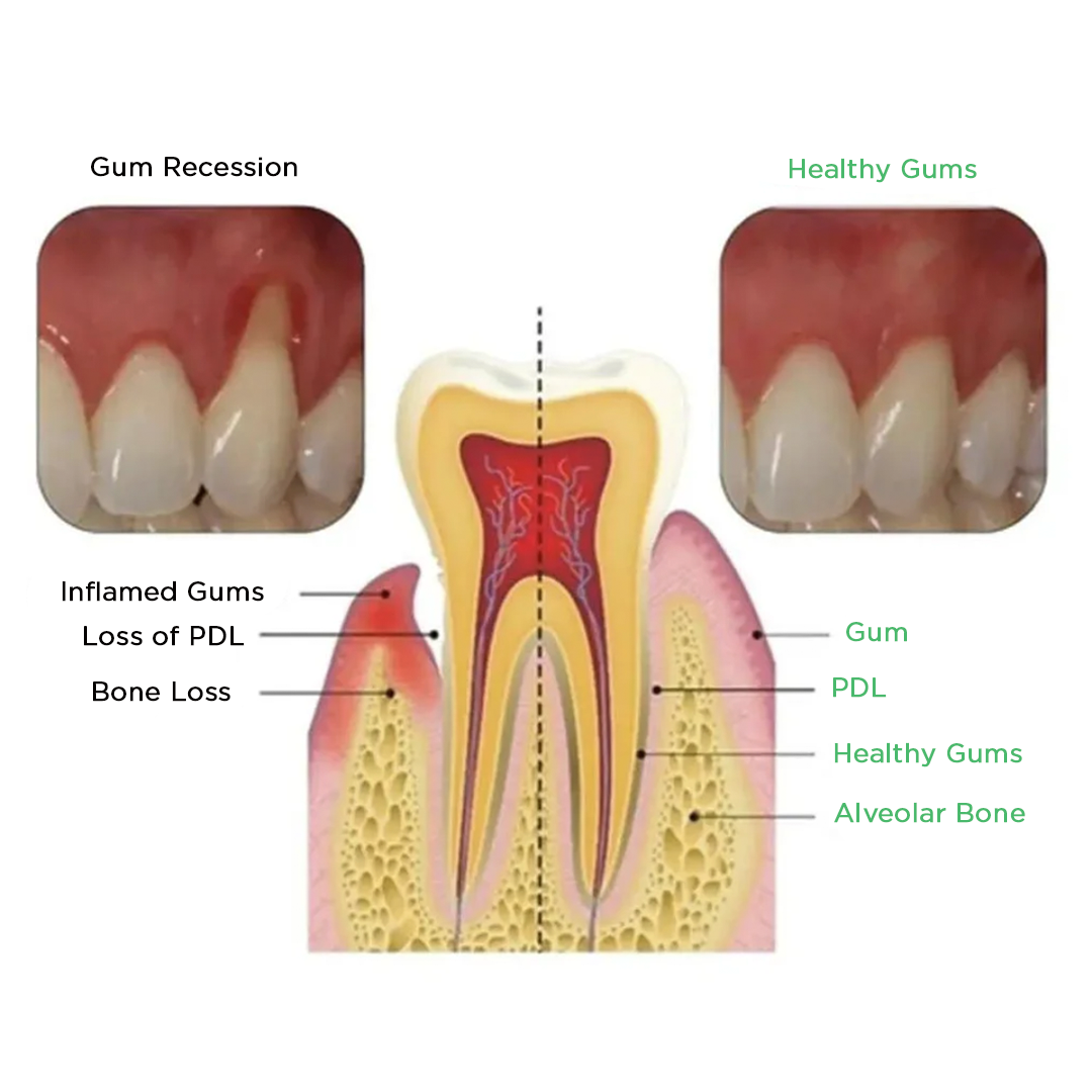 Shark Cartilage Protein Dental Regrowth Drops