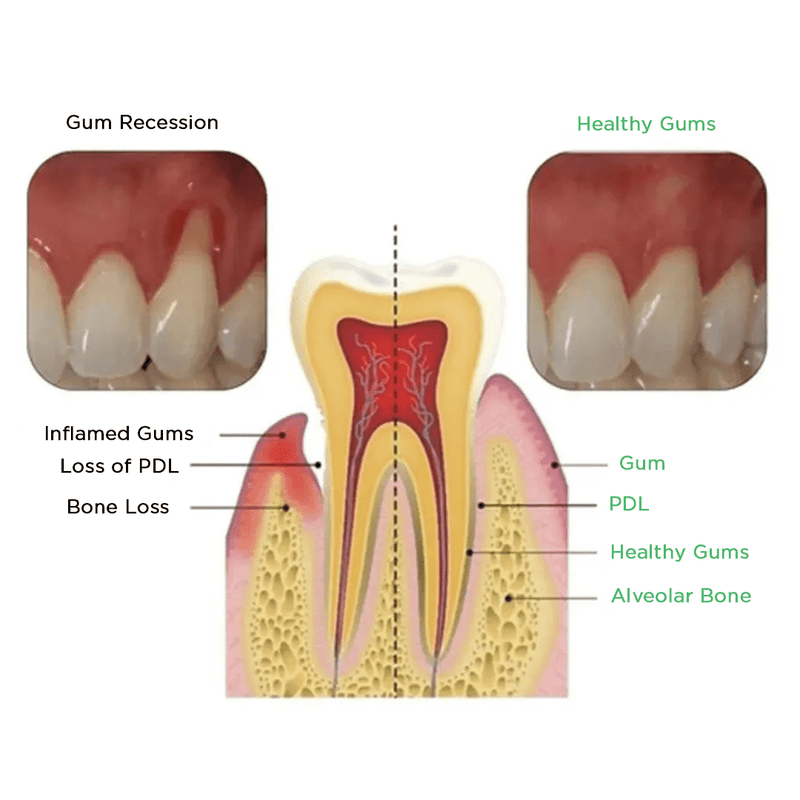 Shark Cartilage Protein Dental Regrowth Drops - Sccoti
