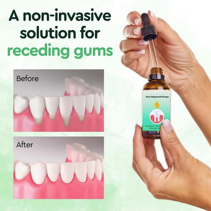 Shark Cartilage Protein Dental Regrowth Drops