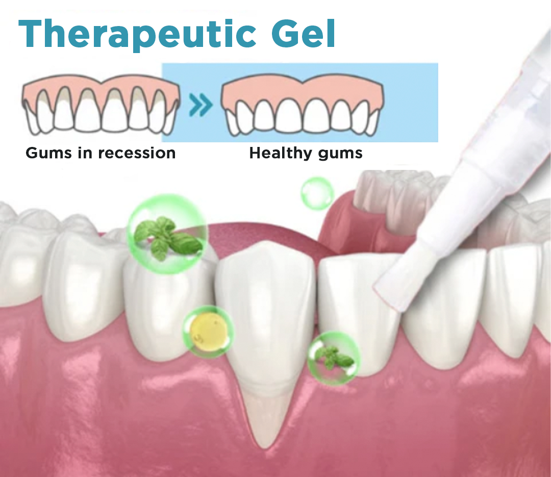 JaySuing™ Therapeutic Gel for Gum Relief