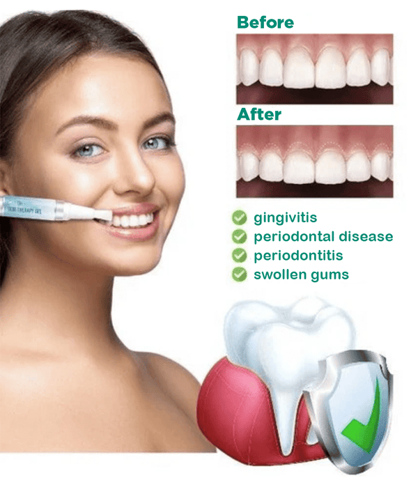 JaySuing™ Teeth Whitening Pen - Sccoti