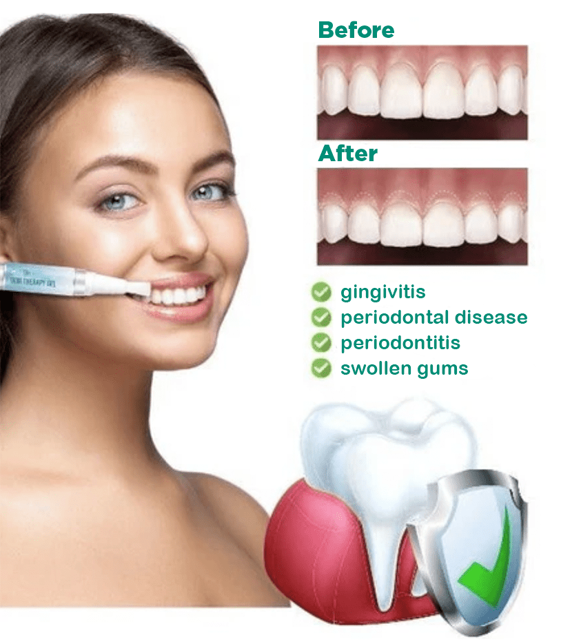 JaySuing™ Teeth Whitening Pen - Sccoti