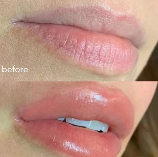 Moisturizing Fruit Glossy Lip Plumper