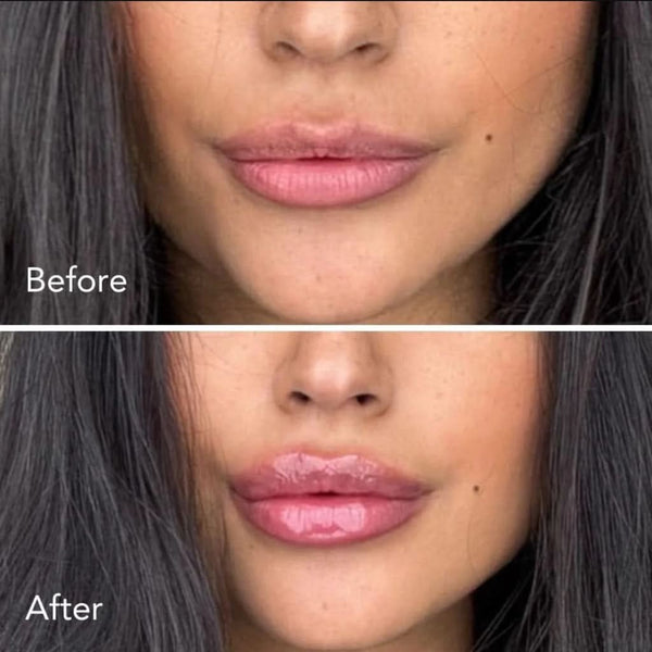 Moisturizing Fruit Glossy Lip Plumper - Sccoti