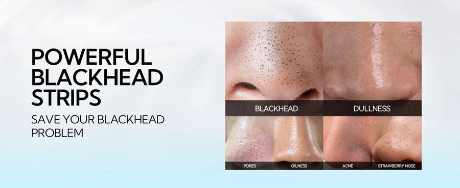 LANBENA Anti - Blackhead Peel Off Mask - Removes Blackheads from Face and Nose - Sccoti
