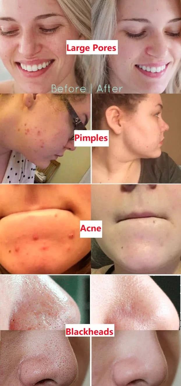 Natural Organic Avocado Deep Cleansing Bubble Mask - Sccoti