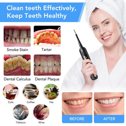 Teeth plaque remover